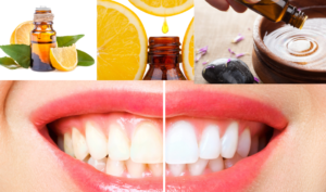 Orange essential oil for teeth brightening is full of vitamin C and citric acid