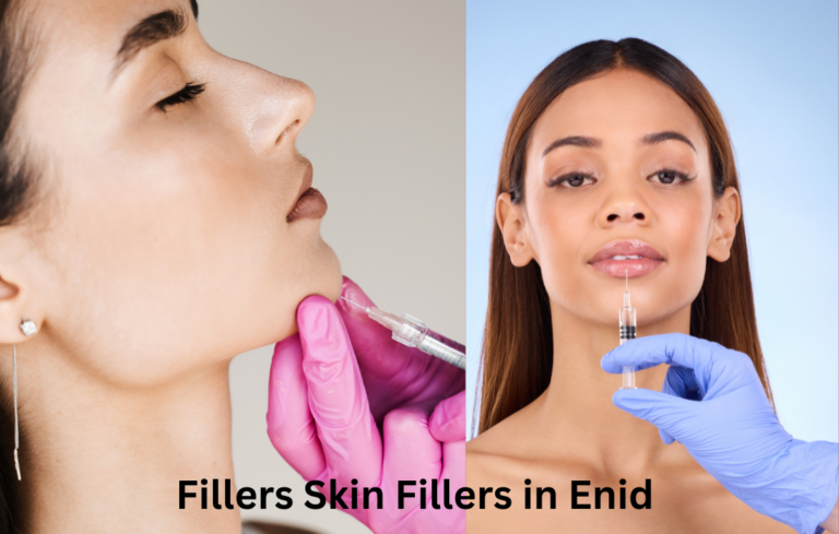 A complete guide about fillers in Enid