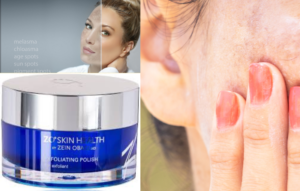 ZO Skin Health Exfoliating Polish reduces pigmentation