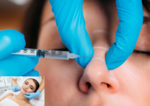 Nostril contouring injection