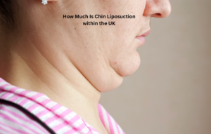 how much is liposuction in your chin