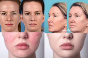 Before-and-after pics showcasing outcomes of laser  skin treatments.