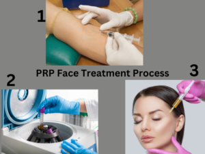 The process of PRP treatment for face in 3 steps