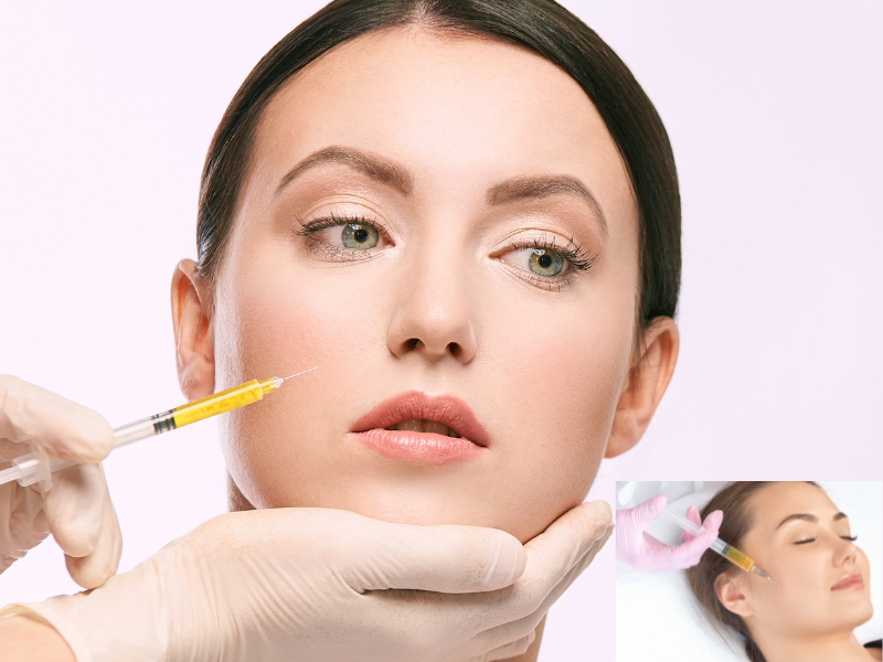 PRP face treatment